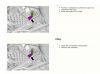 Filename : normal_Capture~695.PNG.jpg
Filesize : 31KB
Dimensions : 700x521
Date added : Apr 29, 2018 normal_Capture~695.PNG.jpg